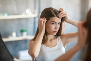 Read more about the article <strong>Scalp Psoriasis: What Is It and How To Treat It?</strong>