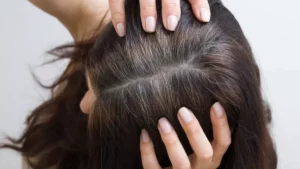 Read more about the article Greying Hair? Here’s What To Do!